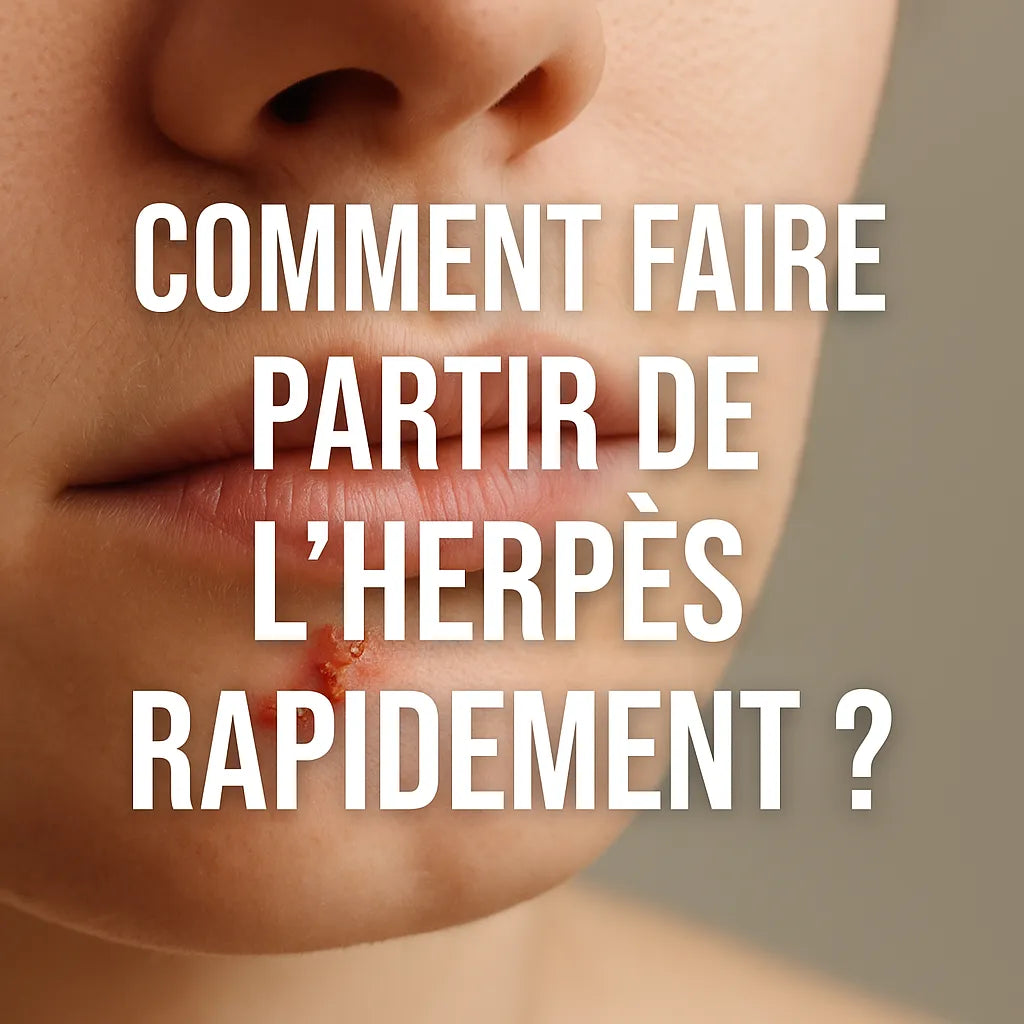 Comment Faire Partir De L'Herpes Rapidement ?