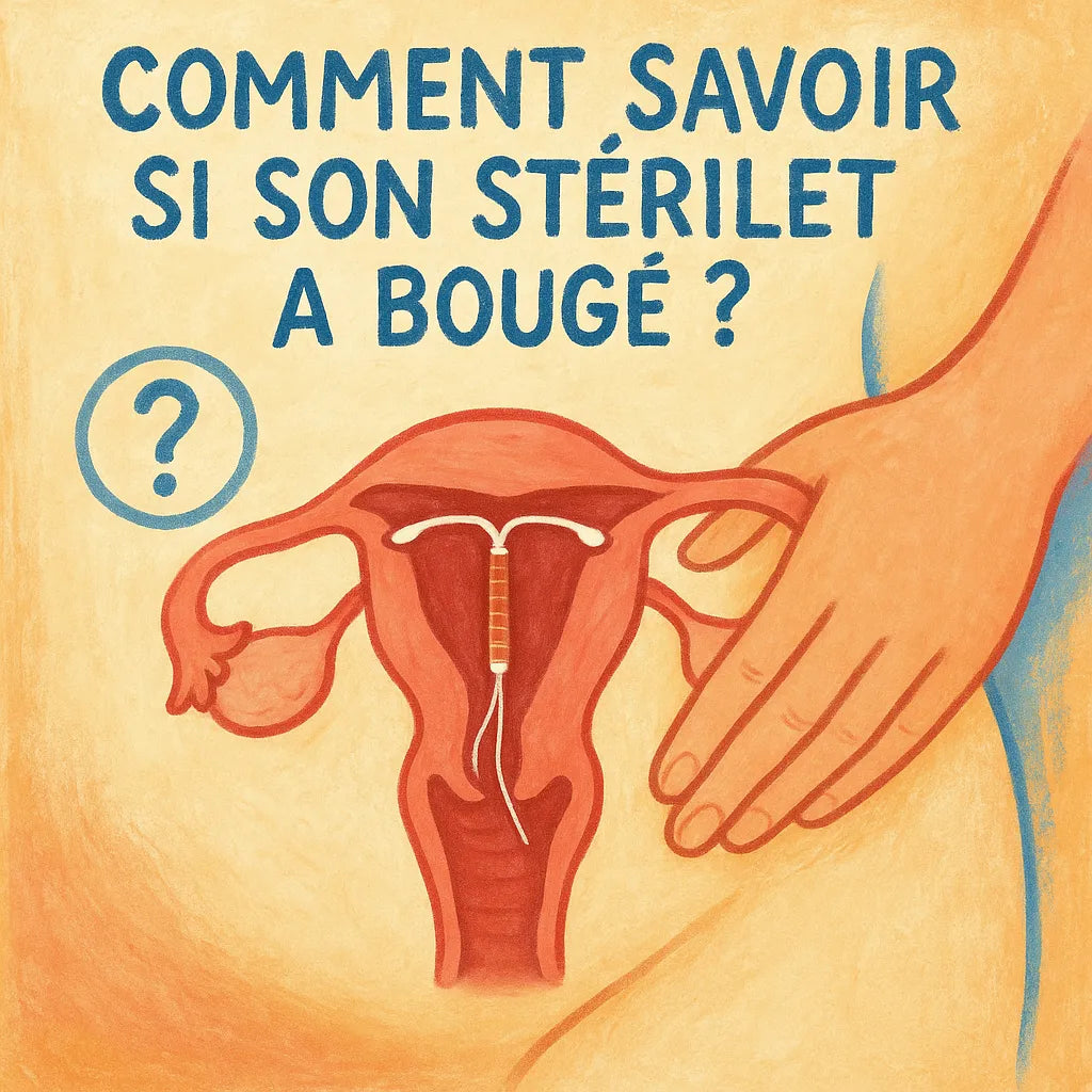 Comment Savoir Si Son Sterilet A Bougé ?