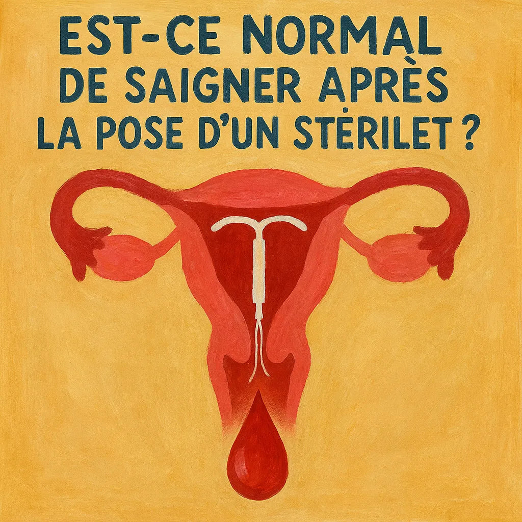 Est-Ce Normal De Saigner Après La Pose D'Un Sterilet ?