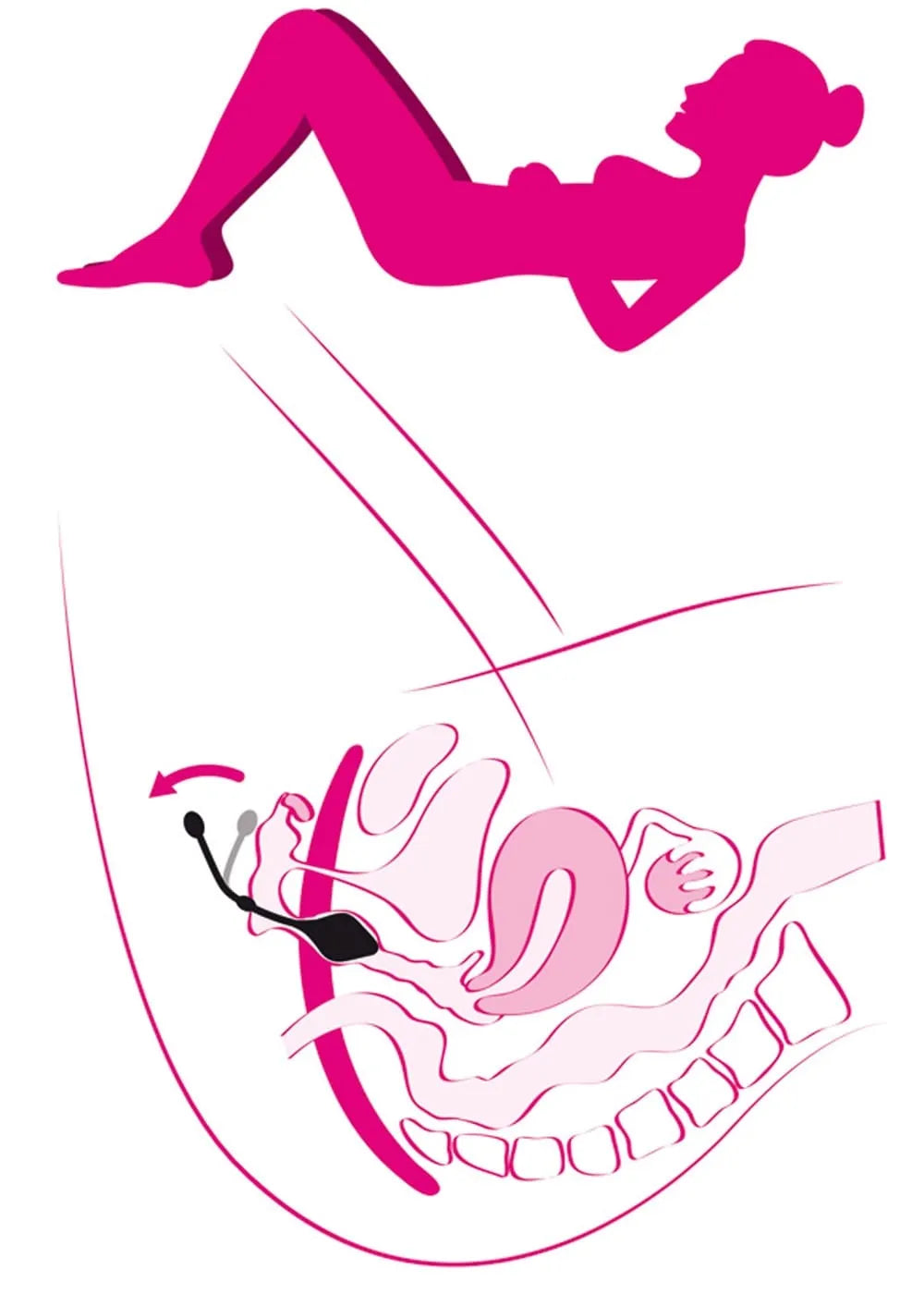 Boules de geisha sensation en trois couleurs et poids, avec livret d'exercices pour rééducation périnéale féminine.