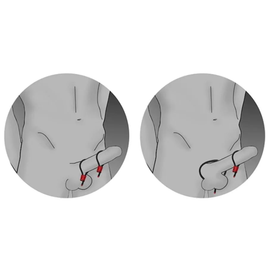 ELECTRASTIM - PRESTIGE ELECTRA LOOPS ANNEAUX PÉNIENS RÉGLABLES ROUGES
