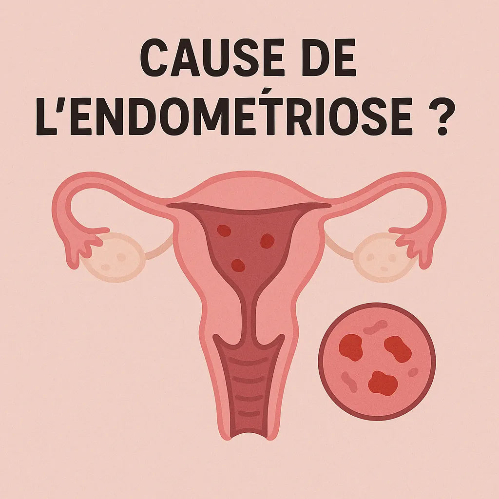 Cause De L'Endométriose ?