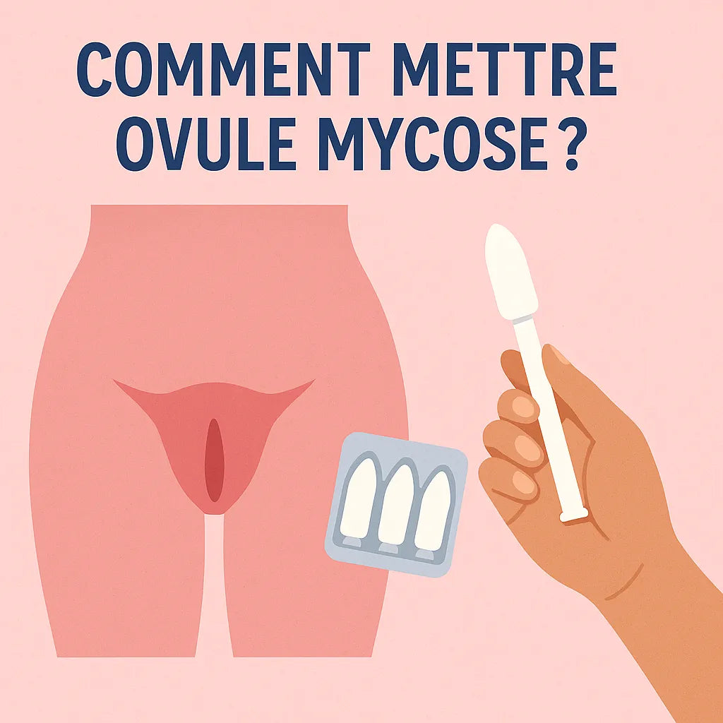 Comment Mettre Ovule Mycose ?