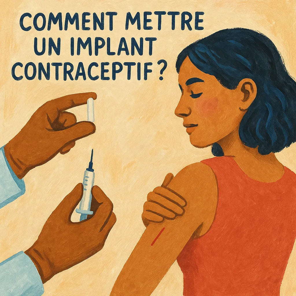 Comment Mettre Un Implant Contraceptif ?